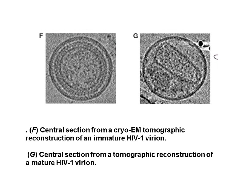 . (F) Central section from a cryo-EM tomographic reconstruction of an immature HIV-1 virion.